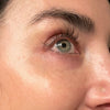 Eye-Wrinkle-Removal-Product-After