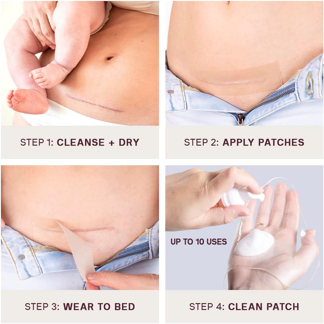 Collagen patches on sale for scars